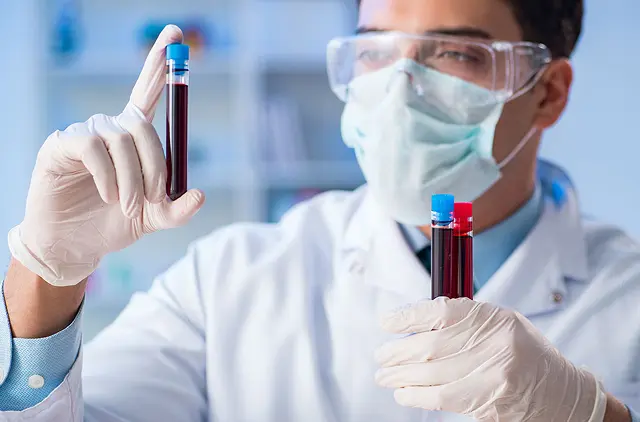 Servicio de hematología